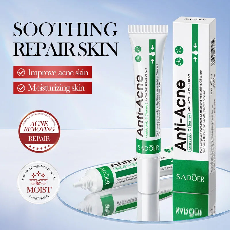 Anti-acne cream tube and packaging with 'Sadoer' branding on a light blue background