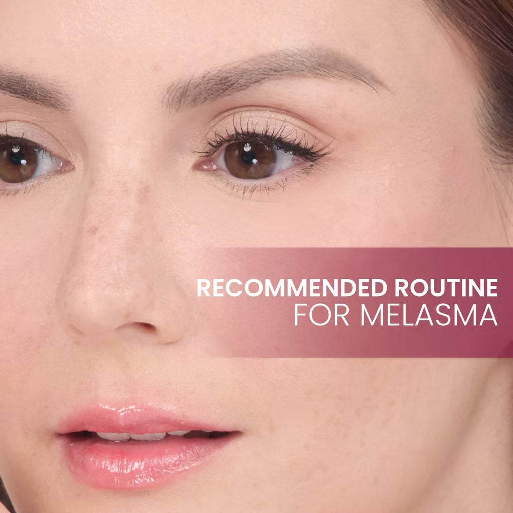 Close-up of a woman's face with text 'Recommended Routine for Melasma' on a beige background