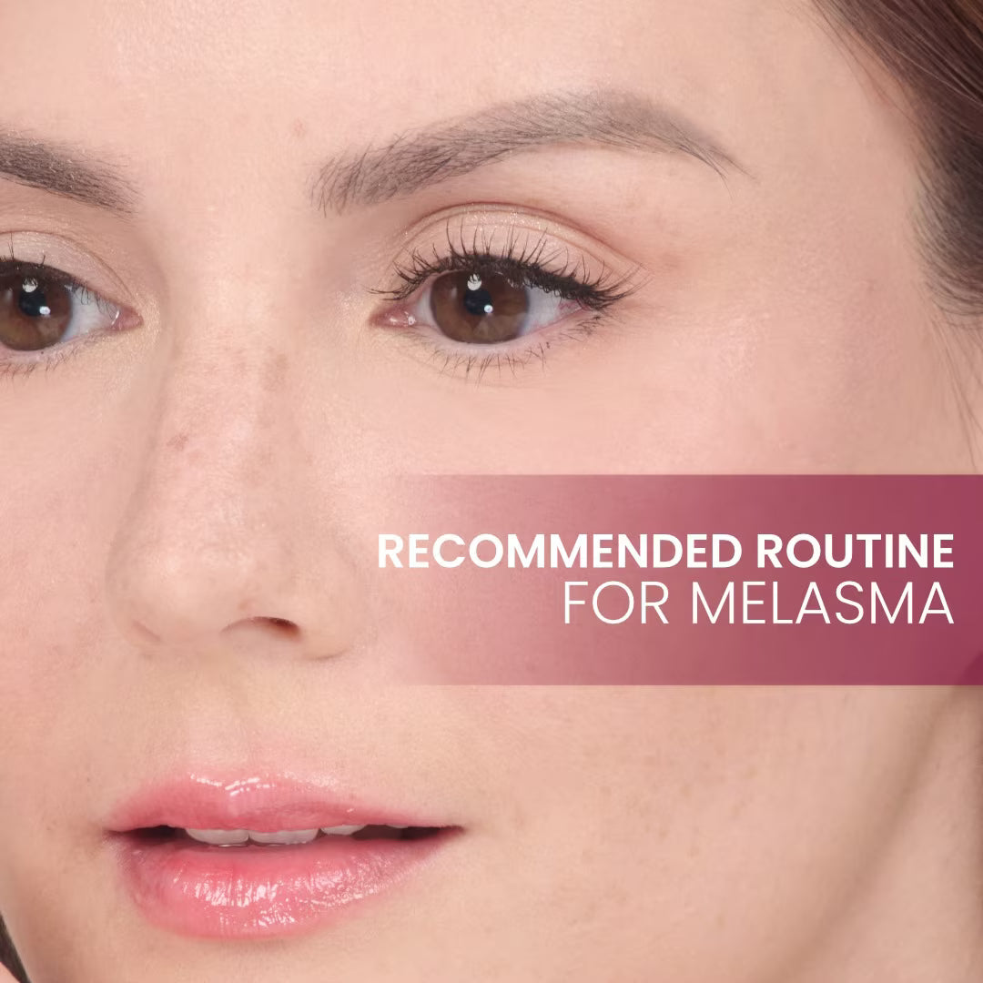 Close-up of a woman's face with text 'Recommended Routine for Melasma' on a beige background