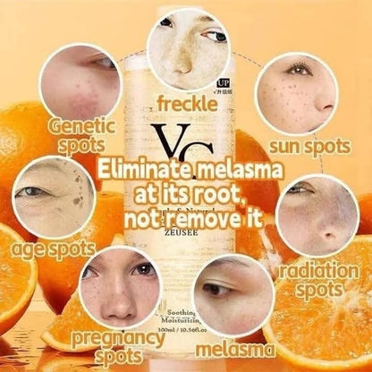 Product packaging with text about eliminating melasma, surrounded by images of skin with different types of spots and oranges.