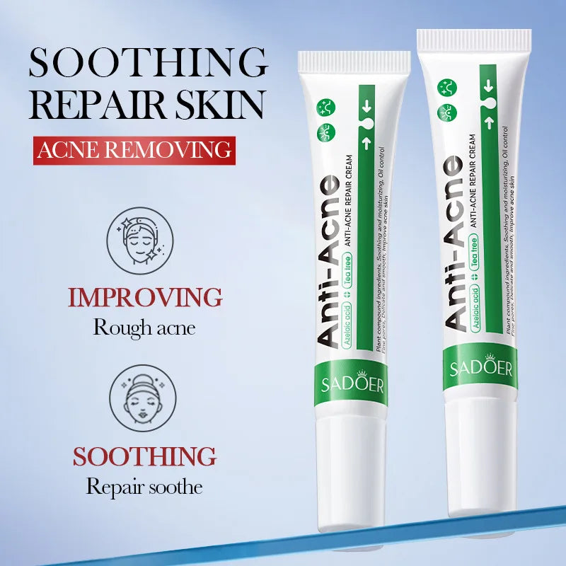 Two tubes of Anti-Acne cream with text highlighting benefits on a blue background