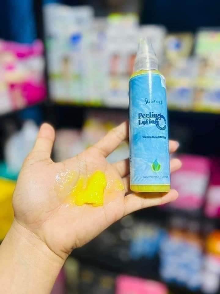 SkeenCare Face & body peeling lotion Whitening Acne ScarsDark Spots Discoloration - Debsline.co  - liquid 