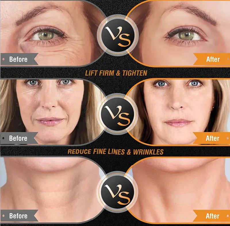 BEEMYI Professional EMS Facial Body RF Machine Skin Tightening Face Lifting Anti-Aging Home Beauty Device for Skin Care