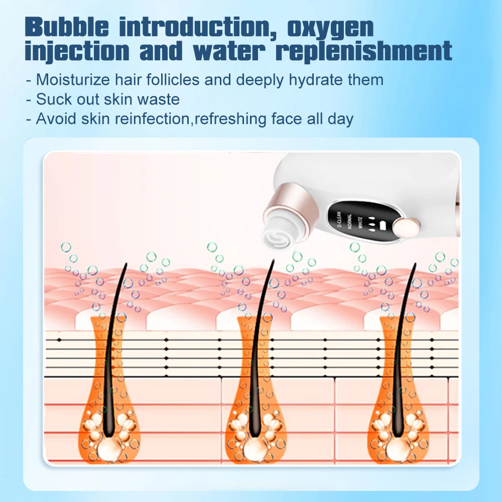 Diagram of skin with hair follicles, bubbles, and text about bubble introduction, oxygen injection, and water replenishment.