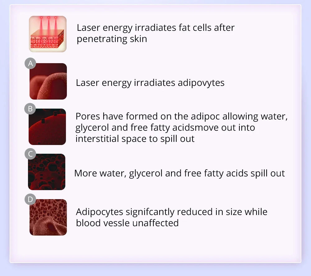 Professional 10-in-1 Ultrasonic Cavitation & RF Beauty Machine