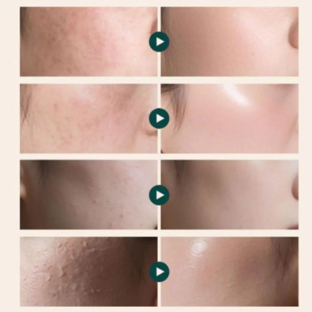 Collage of skin before and after treatment with a focus on texture and condition.