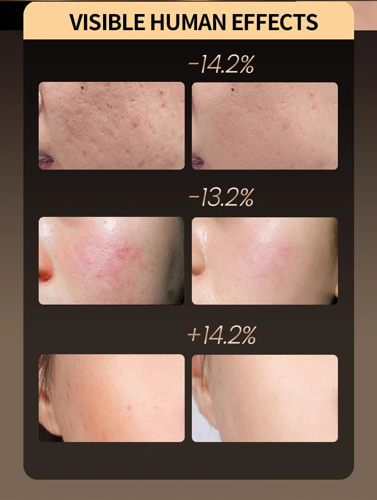 7-Color LED Facial Mask - Light Therapy Skincare Device | Rejuvenation & Firming