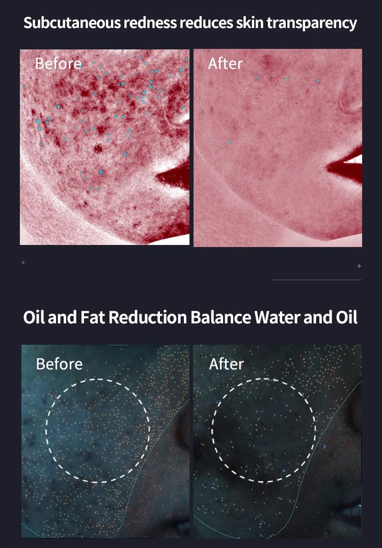 7-Color LED Facial Mask - Light Therapy Skincare Device | Rejuvenation & Firming