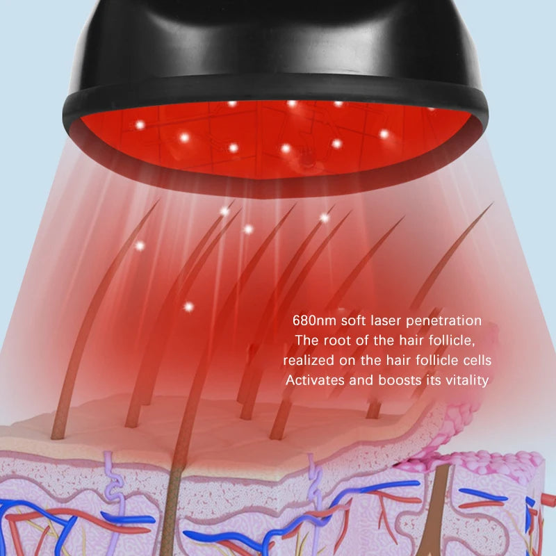 Illustration of a laser device with red light penetrating skin layers, showing hair follicle activation.