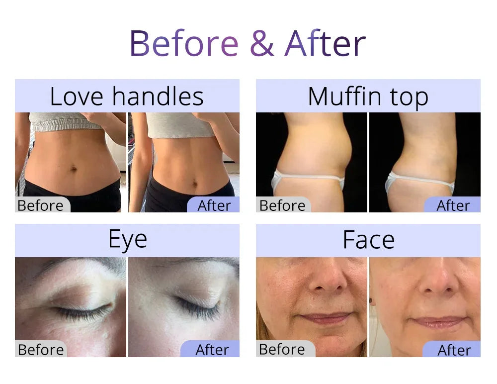 Professional 10-in-1 Ultrasonic Cavitation & RF Beauty Machine