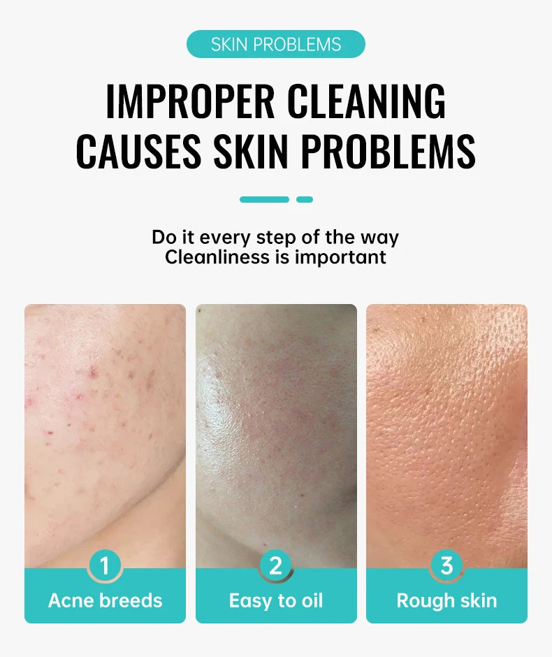 Salicylic Acid Acne Treatment Cream – Pore Refining & Scar Repair Moisturizer