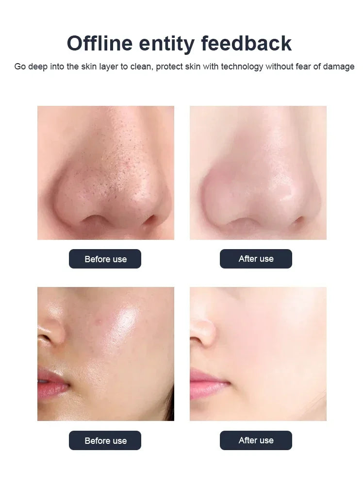 2025  Newest 11 In 1 H2o2 Aqua Peeling Lift Skin Bubble Moisturizer Oxygen Hydrofacial Machine, Skin Care Cleansing Facials