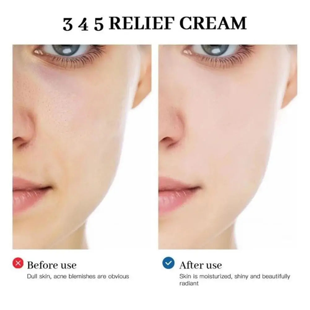 345 Relief Cream Korean Dr. Althea Antioxidant Relief Cream  Soothing Hydrating Repair Clean Acne For Oily Skin Care