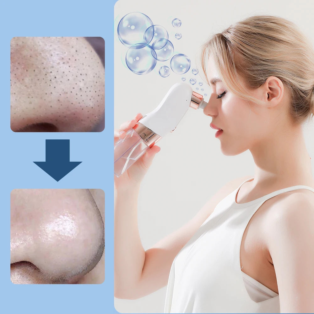 Woman using a skin care device on her nose with before and after results shown.