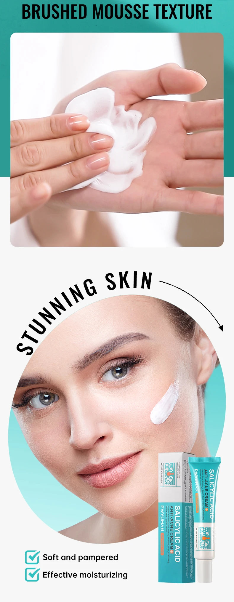 Salicylic Acid Acne Treatment Cream – Pore Refining & Scar Repair Moisturizer