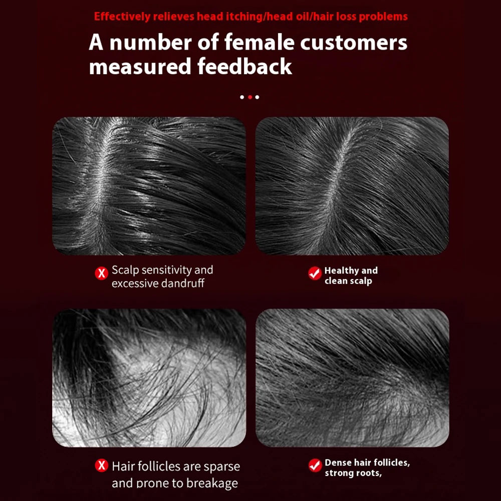 Electric Hair Growth Comb Red Light Scalp Massage Brush Hair Oil Applicator for Hair Care And Massage